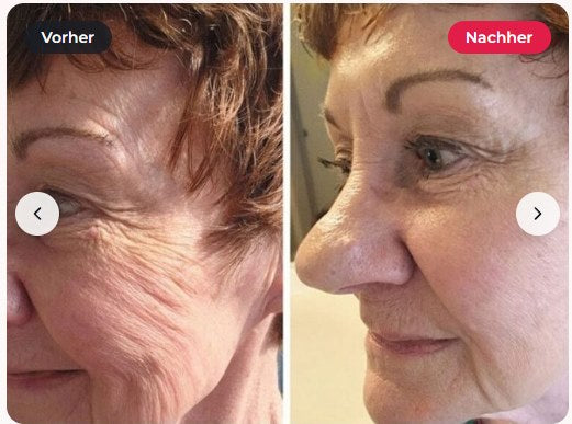 Before and after photo