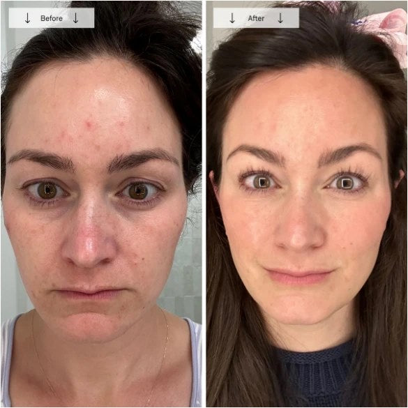 Before and after photo