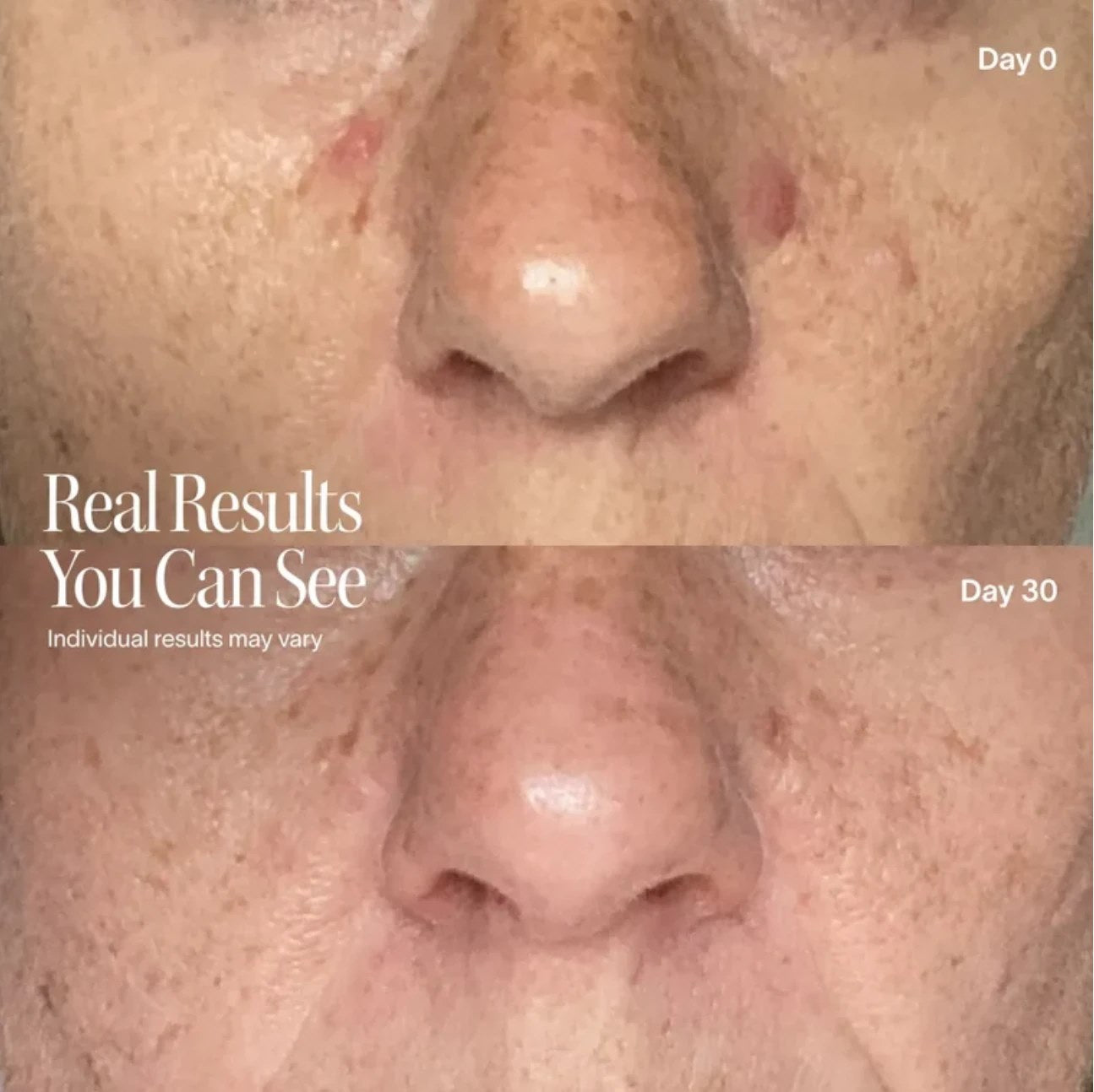 Before and after photo