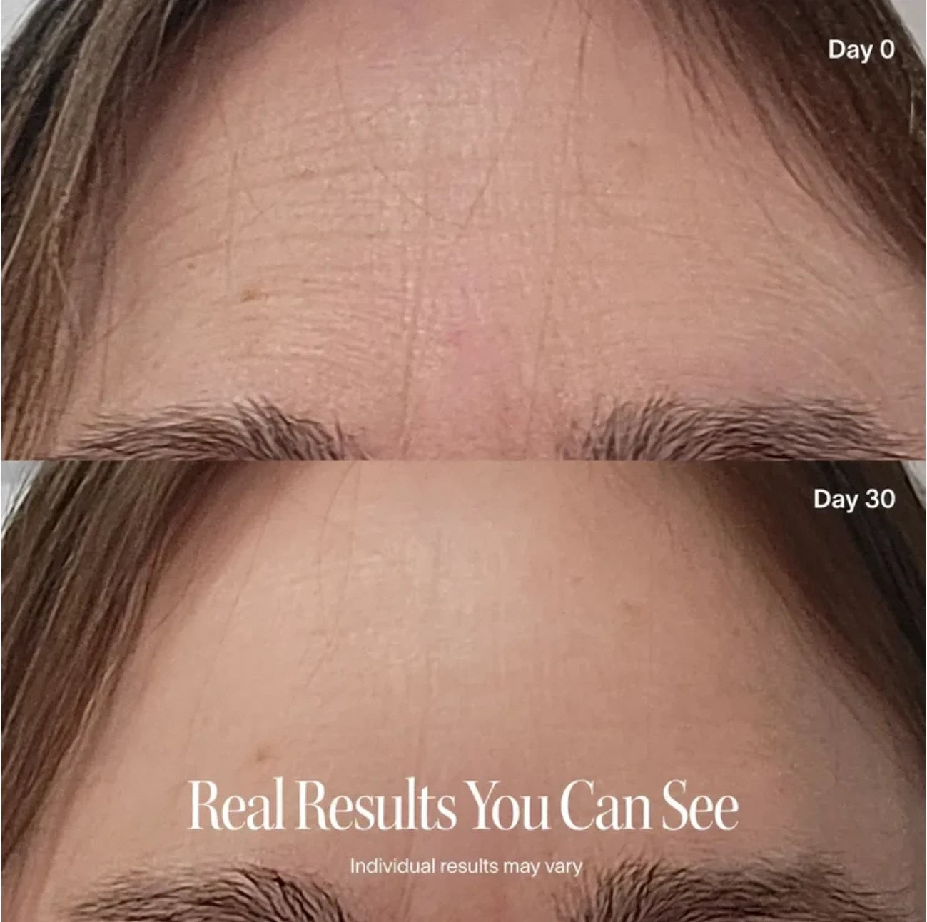 Before and after photo