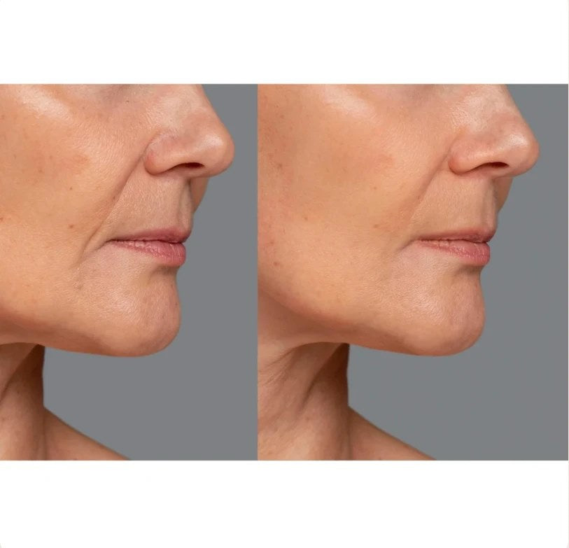 Before and after photo