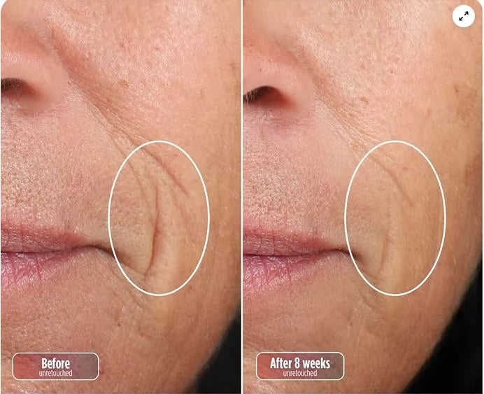 Before and after photo